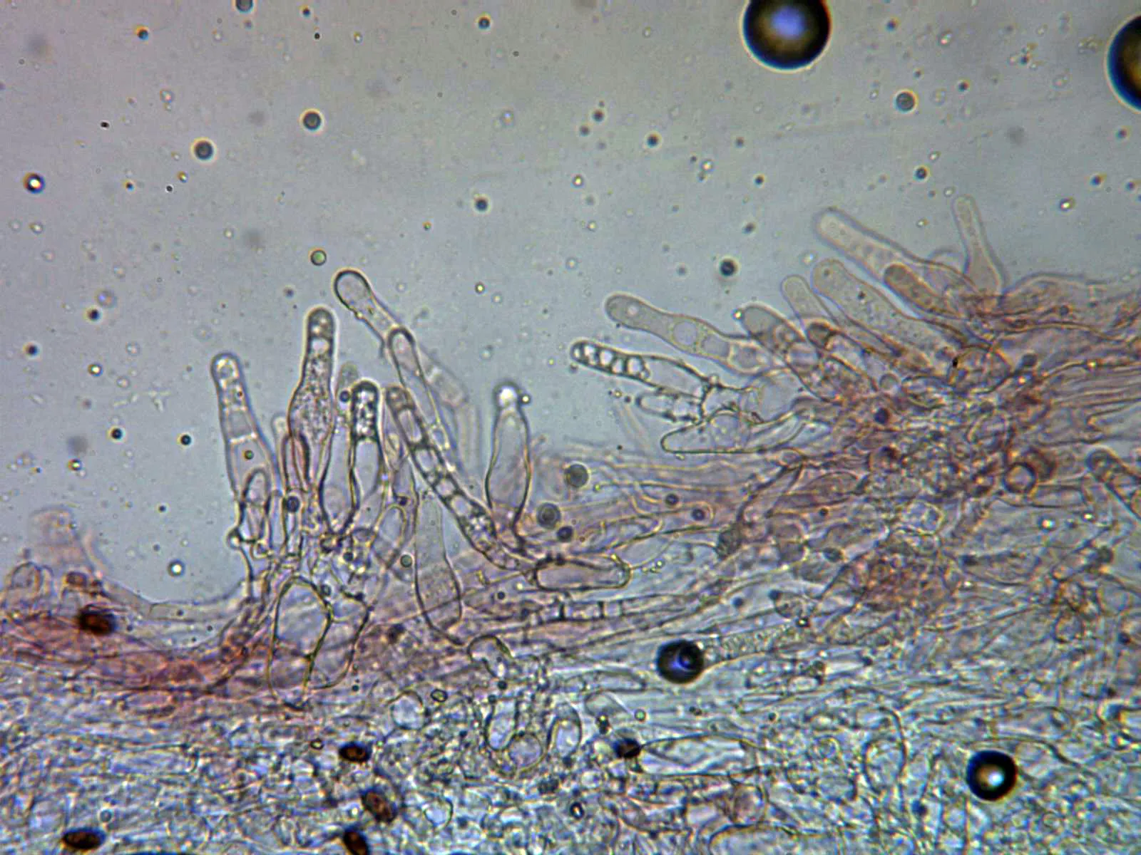 Microscopía de Psathyrella arenosa - 10 - Caulocistidios x 400